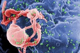 HIV gets deadlier: virus rooted in America, not Africa